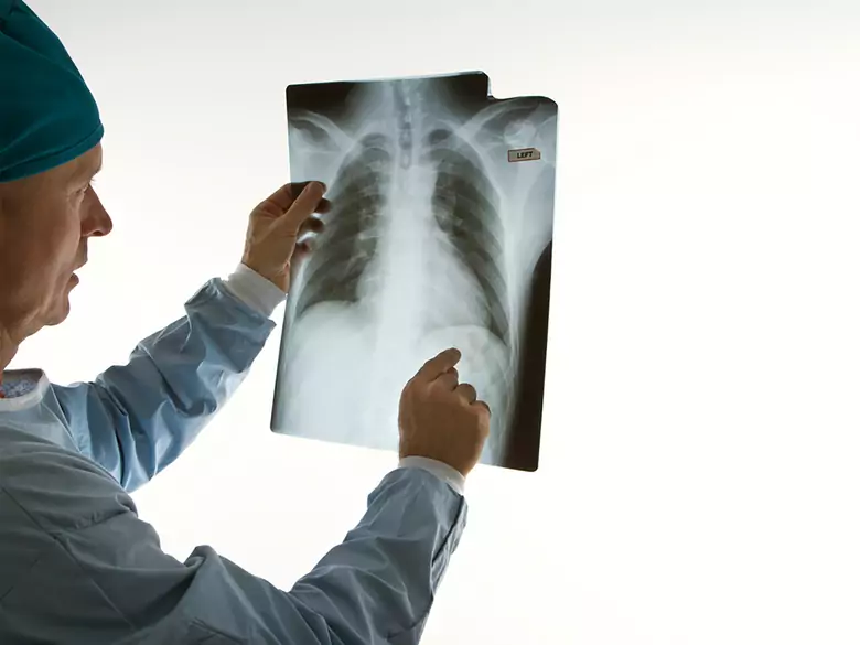 Kurzatmigkeit bei Bronchitis und Lungenentzündung 