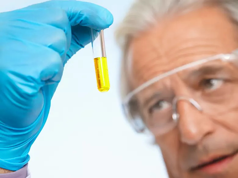 Urintestergebnis - Bakterien vorhanden