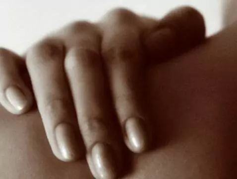 Ringelflechte - Ursachen, Symptome, Diagnose, Behandlung