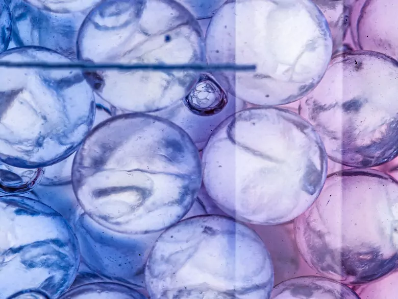 Ätzende Säurevergiftung - Ursachen, Symptome, Diagnose, Behandlung