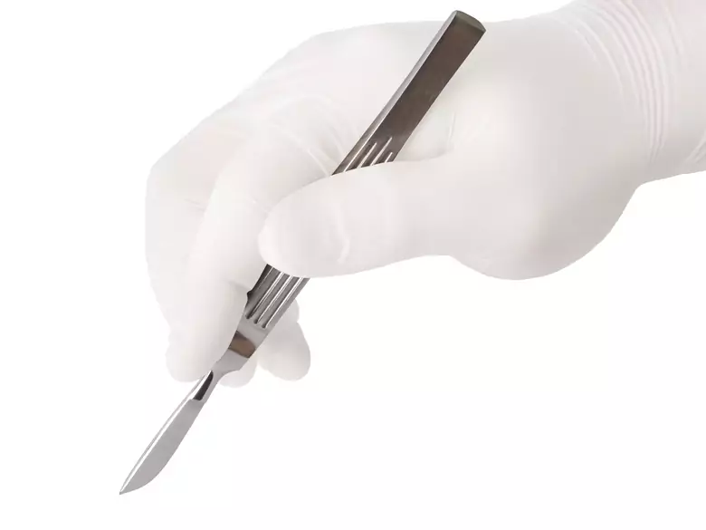 Beschneidung reduziert das Risiko von Prostatakrebs