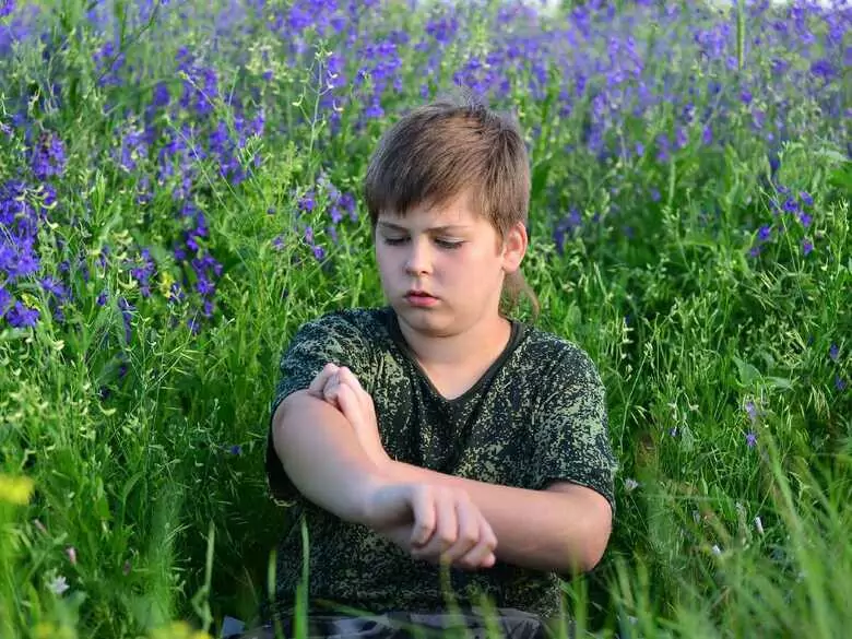 Kontaktallergie bei Kindern: Studien über mögliche Auslöser