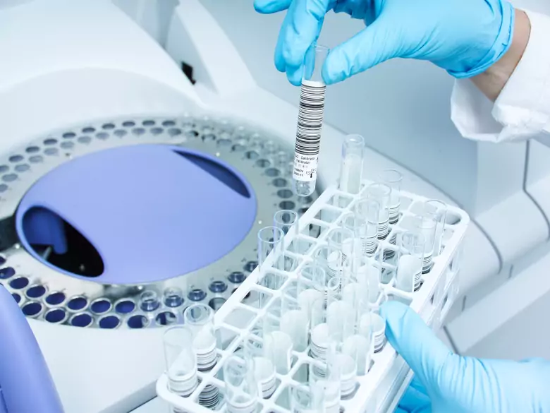 Gen, das zwischen Zucker und Süßstoff unterscheidet