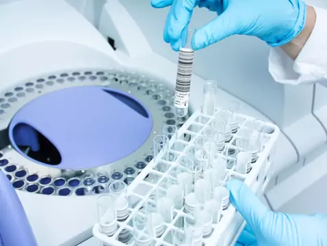 Unfruchtbarkeit - welche Tests sollten durchgeführt werden?