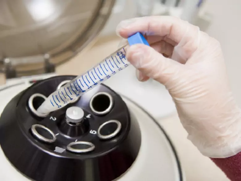 Der 4. Oktober ist der Internationale Krebstag