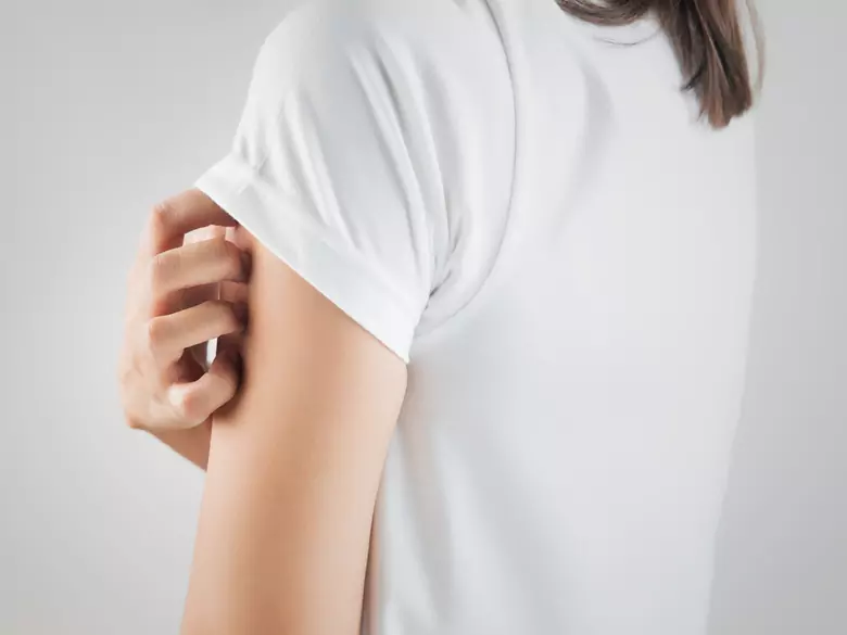 Wie geht man mit übermäßiger Seborrhoe der Haut um?