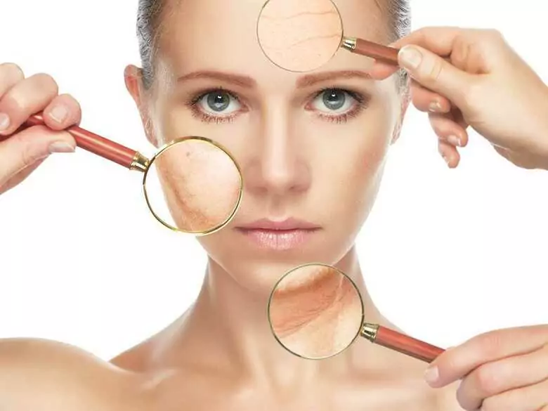 Rissige Blutgefäße (Besenreiser) am Körper: Ursachen