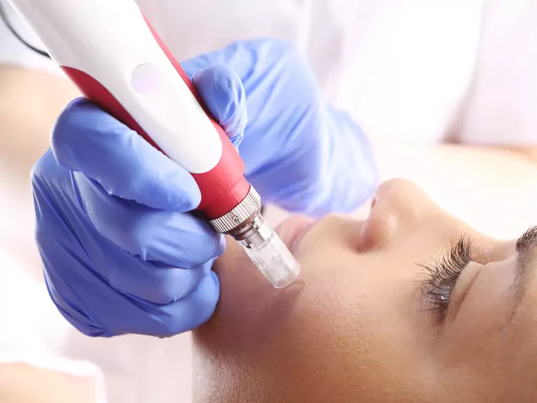 Talgzyste der Haut (Talgzyste) - Informieren Sie sich über Behandlungsmöglichkeiten