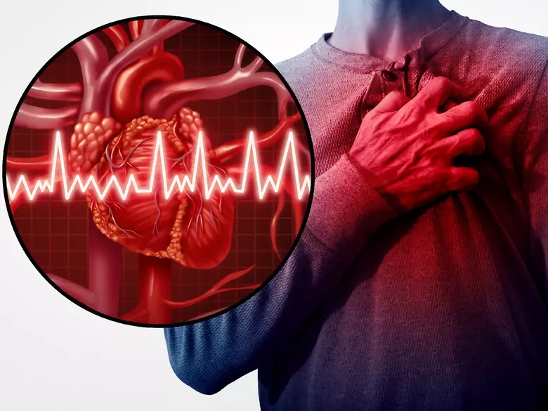 Vitamin D und kardiovaskuläre Erkrankungen