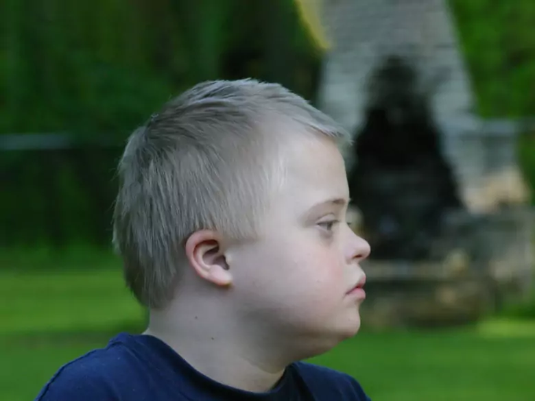 Definition und Arten der mentalen Retardierung