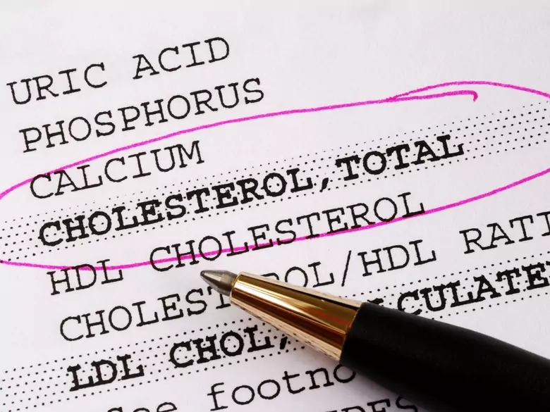 LDL-Apherese, die mechanische Entfernung von Cholesterin aus dem Blut