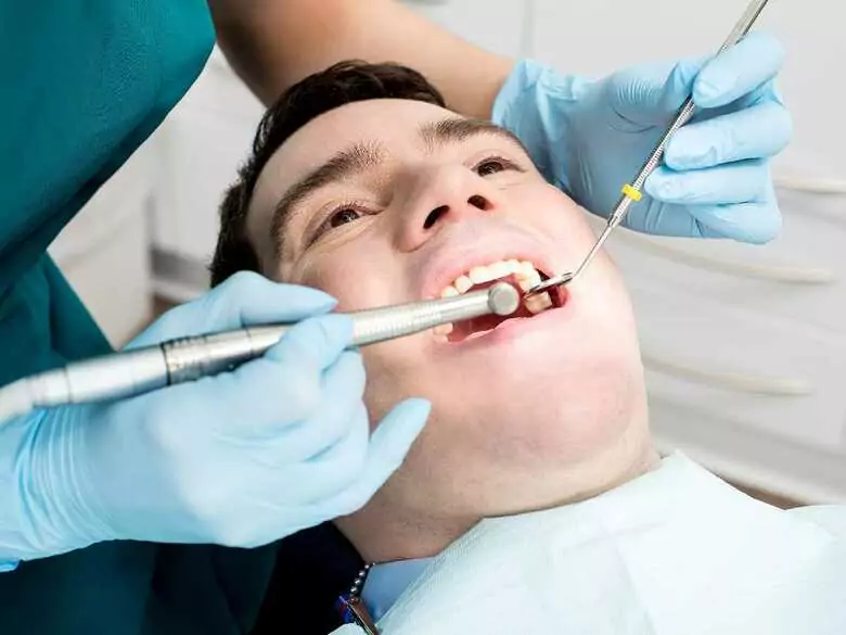 Zahnveneers - Vor- und Nachteile