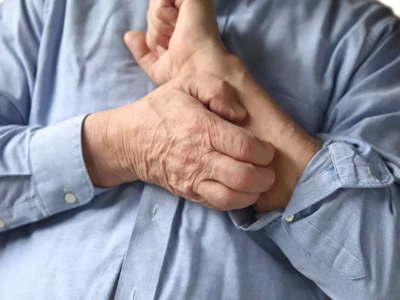 Psychogener Pruritus: die Verbindung zwischen Dermatologie und Psychiatrie