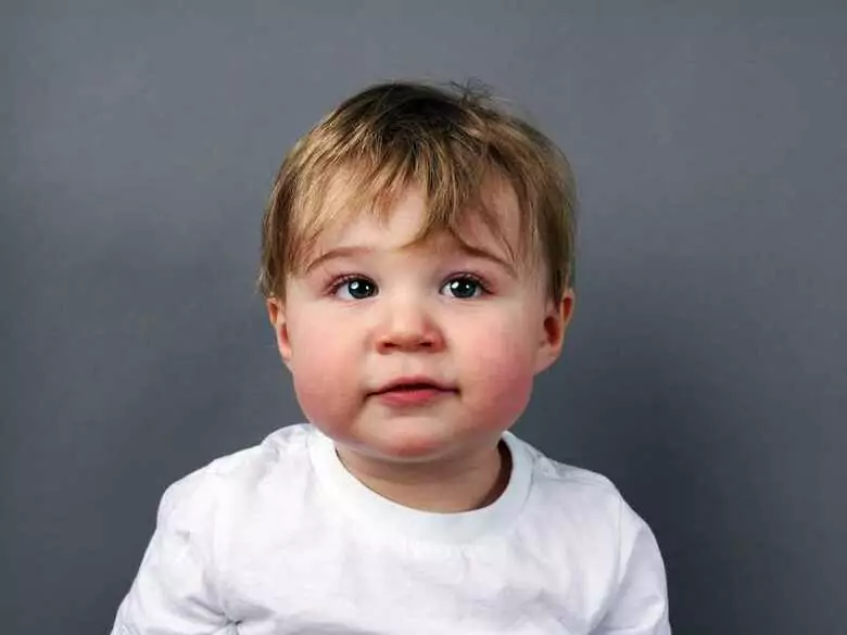 Infektiöse Impetigo - Ursachen, Symptome, Diagnose, Behandlung