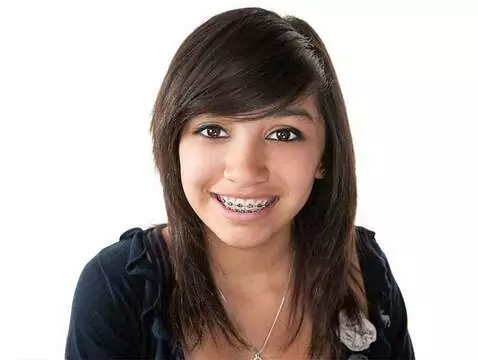 Zahnspange - alles über Zahnspangen