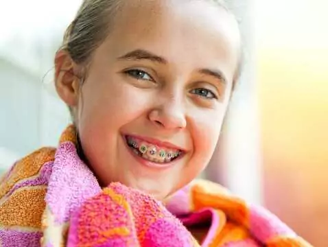 Mundhygiene mit Zahnspange