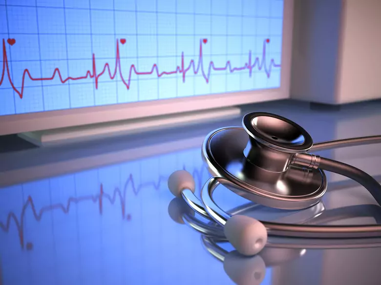 Myokardinfarkt - Ursachen, Symptome, Diagnose, Behandlung