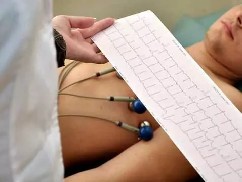 Was ist ein EKG-Test?