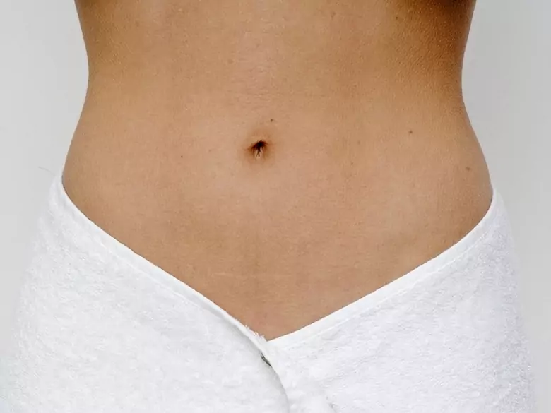 Labiale Hypertrophie