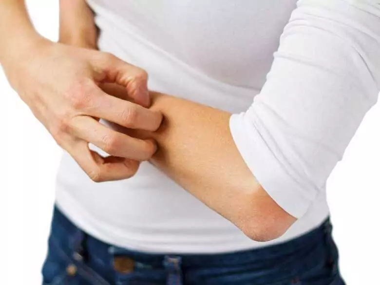 Rissige Haut an den Händen nach der Verwendung von Spülmitteln - ist es schon eine Allergie?