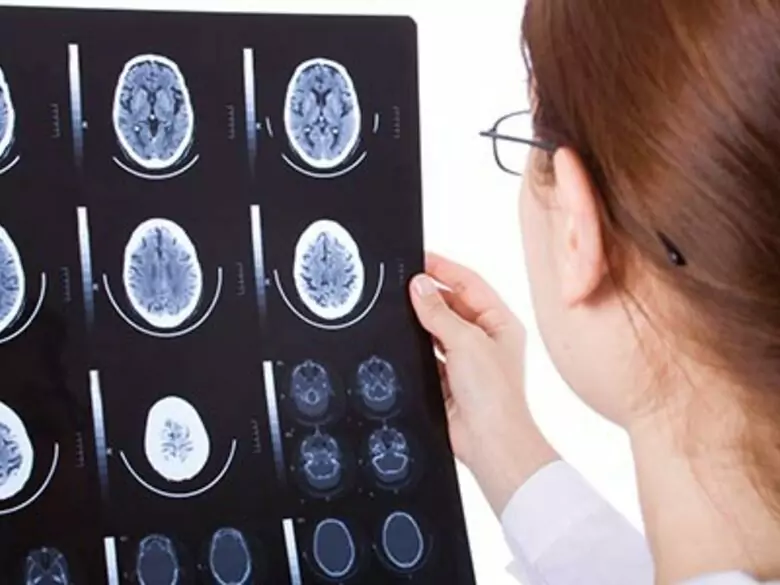 Das Neuron als Überträger von wichtigen Informationen