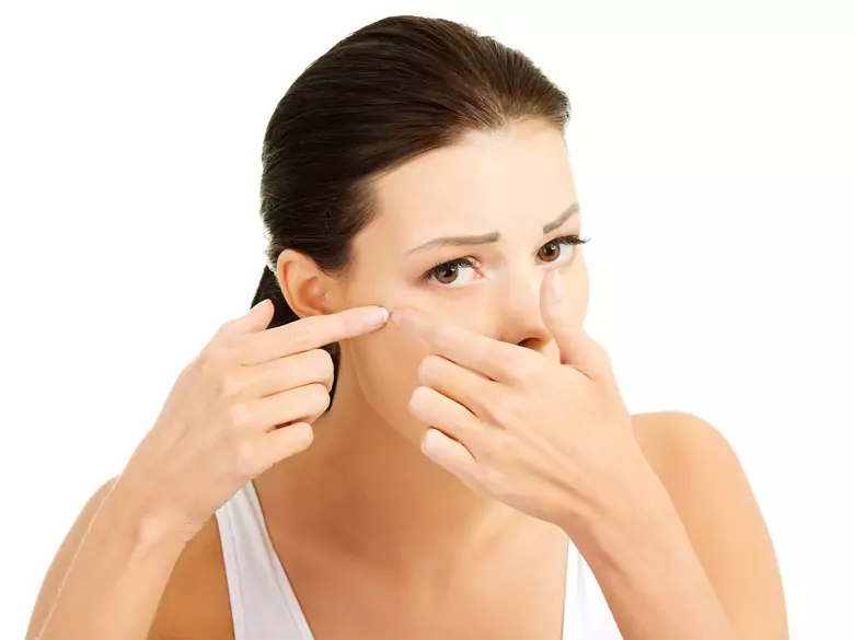 Hormontherapie bei Frauen mit Akne