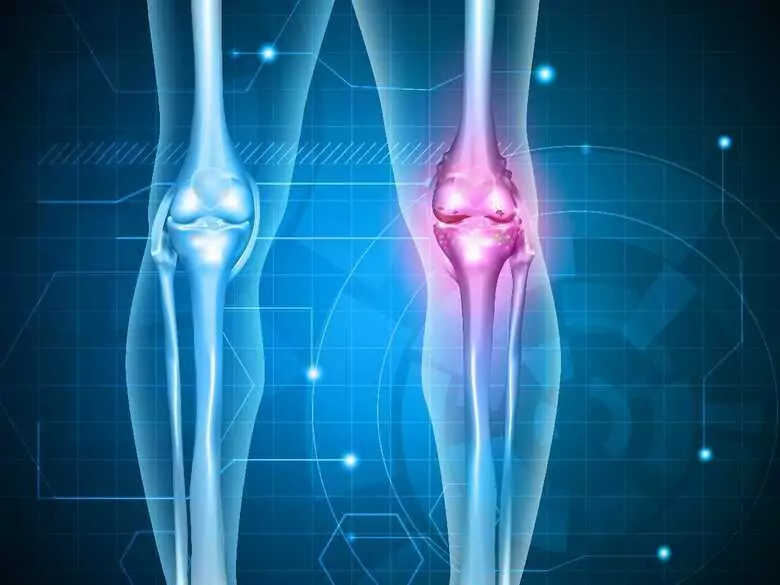 Gebrochene Knochen zusammenkleben - ist das möglich?