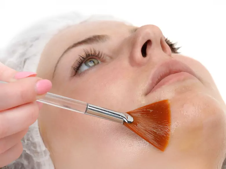 Wie kann ich mich vor Mitessern schützen?