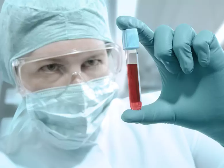 Gilt das Risiko einer HIV-Infektion auch für schwangere Frauen?