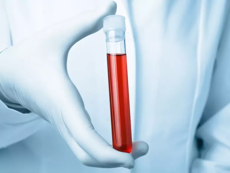 Gestörte Blutgerinnung - was sind hämorrhagische Diathesen?