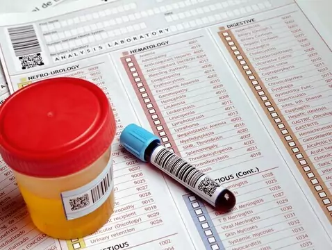 Endokrinologie der Menopause