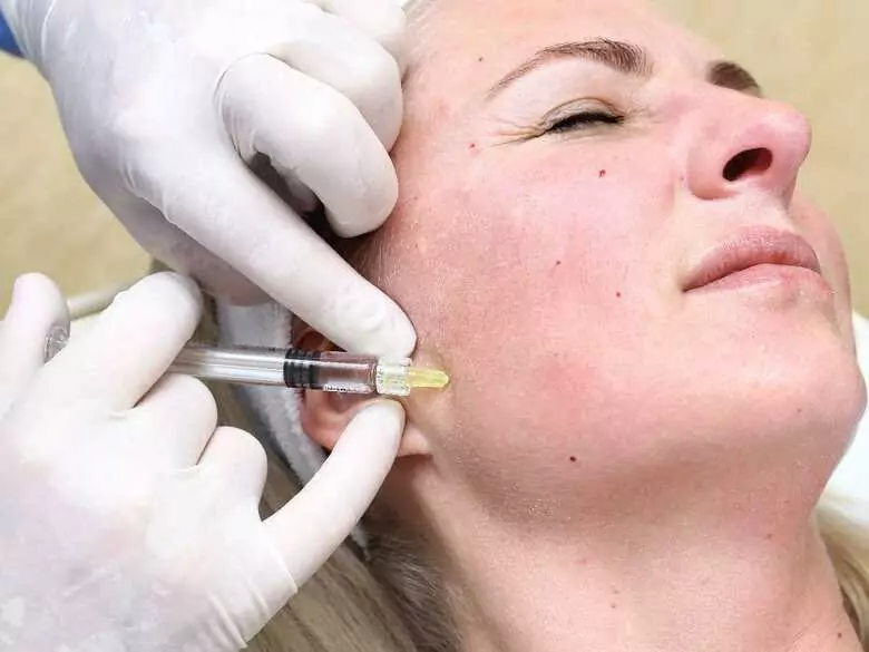 Für Falten, nicht nur Botox