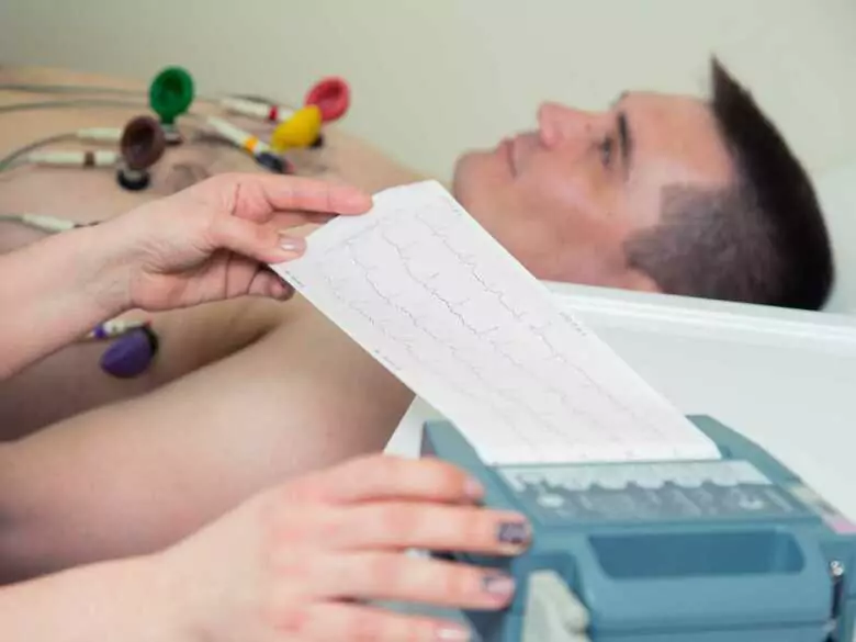 Herzrhythmusstörungen