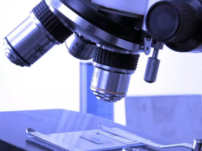 Symptome und Verlauf der Toxocariasis