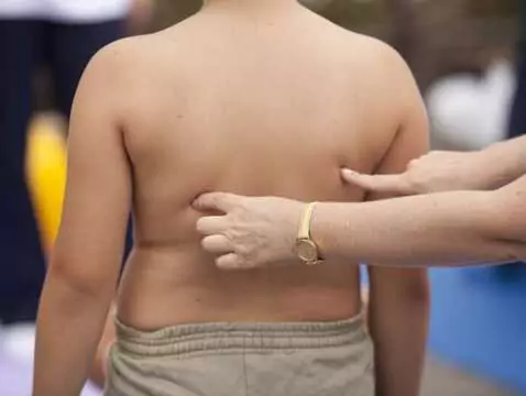 Atherosklerose und Herzinfarkt bei Kindern - ist das möglich?