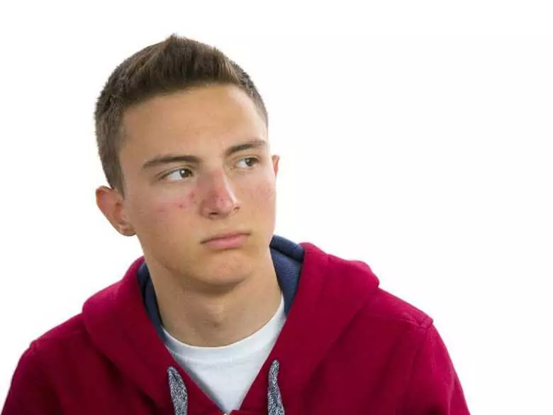 Afterburbs - wie erkennt man, ob ein Kind sie genommen hat?