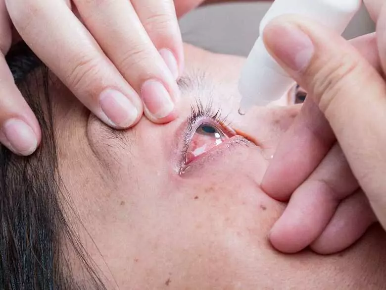 Langfristige Rötung des Auges und ihre Auswirkungen