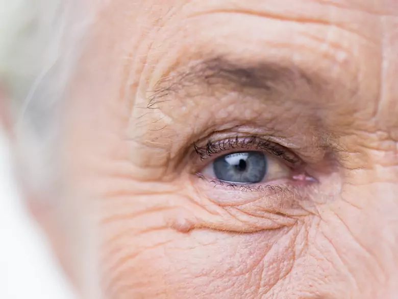 Dermatologische Aspekte der Menopause - der Einfluss der Hormone