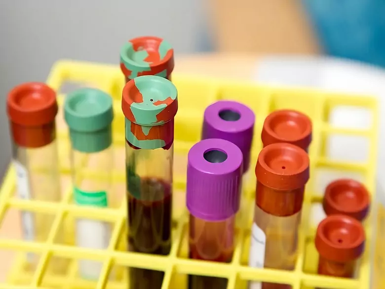 Oncopackage - warum sind Mikronährstofftests für die Krebserkennung so wichtig?