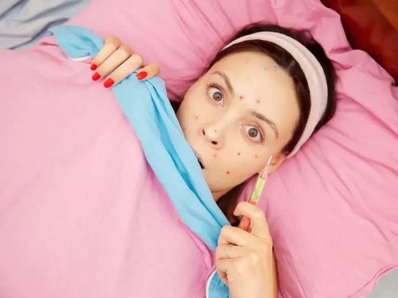 Symptome und Folgen von Windpocken im Erwachsenenalter