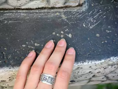 Nagelpilz - Ursachen, Symptome, Diagnose, Behandlung