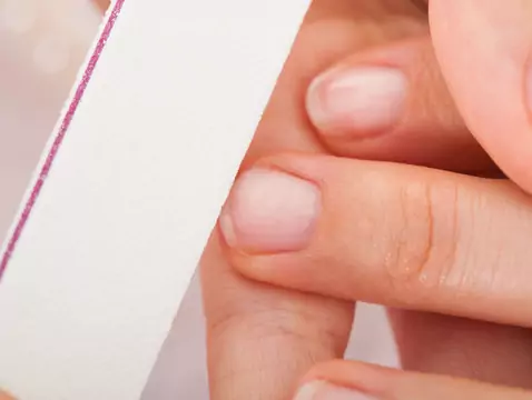 Nagelplattenveränderungen und Ringelflechte