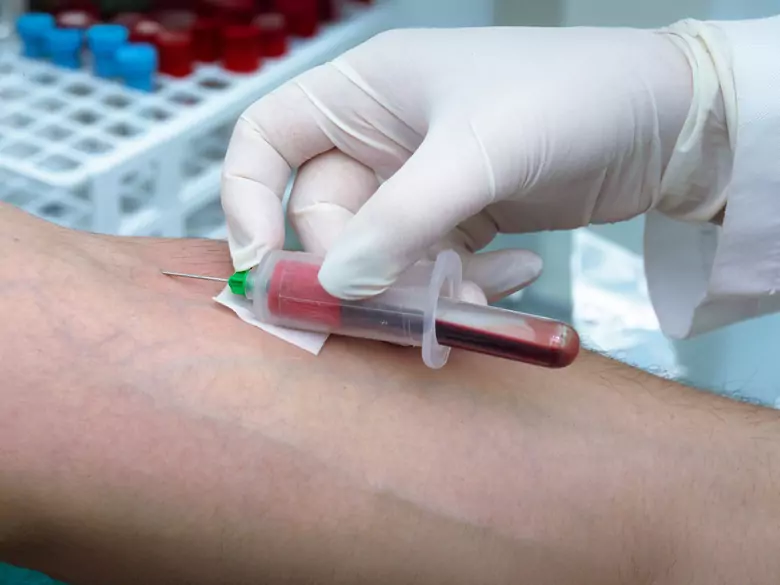 Drogentests für den Körper