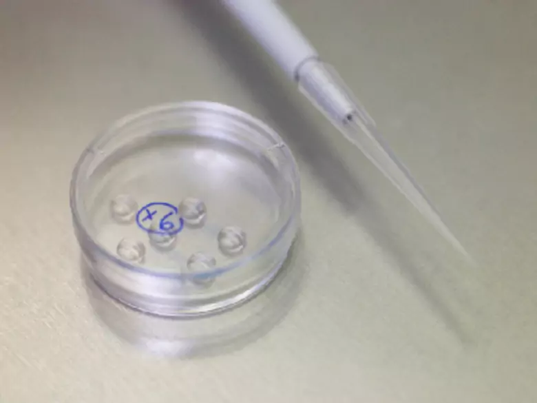 Haemophilus influenzae in einem Rachen- oder Nasenabstrich - Ursachen, Symptome, Diagnose, Behandlung