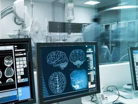 Epilepsie - ein Kompendium des Wissens über Epilepsie