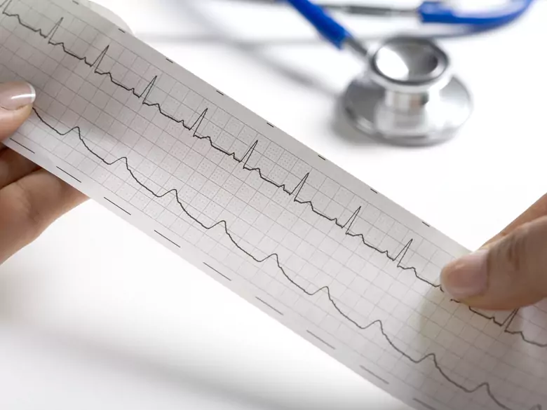 Kardiale Anämie - Ursachen, Symptome, Diagnose, Behandlung