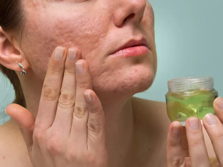 Wege zur Entfernung von Narben