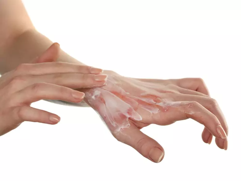 EB - Blasenbildende epidermale Separation