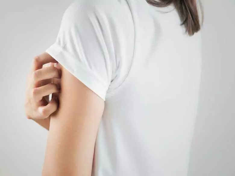 Was ist eine Kontaktallergie?