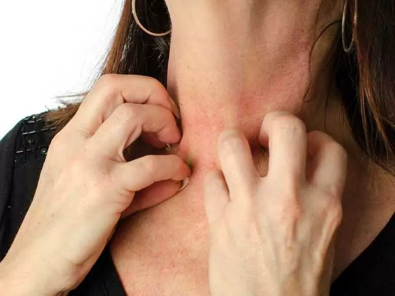 Warum juckt die Haut?